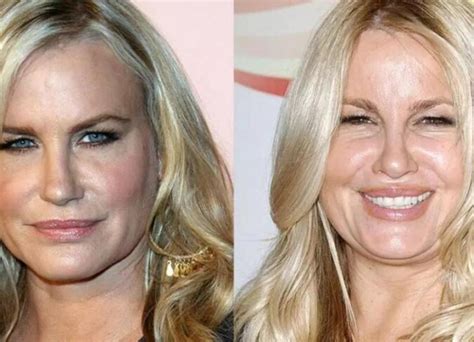 jennifer coolidge before plastic surgery|Jennifer Coolidges plastic surgery and stunning transformation